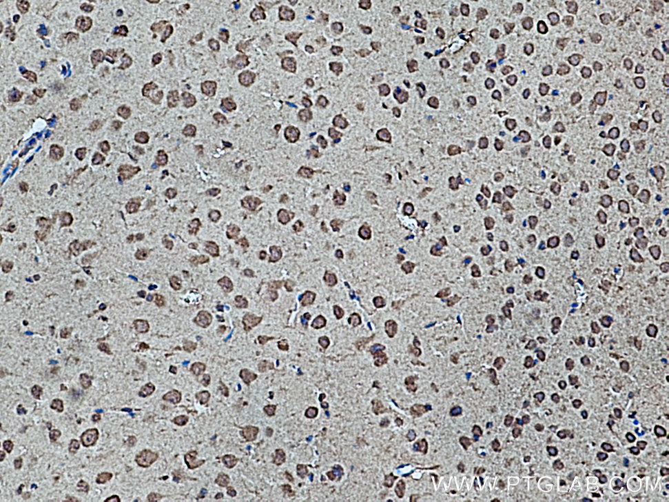 Immunohistochemistry (IHC) staining of mouse brain tissue using BCAT1 Polyclonal antibody (13640-1-AP)