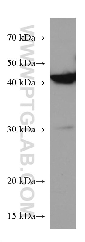 Western Blot (WB) analysis of pig brain tissue using BCAT1 Monoclonal antibody (67084-1-Ig)