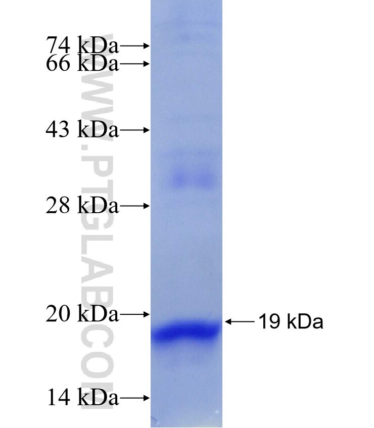 BCAT1 fusion protein Ag28998 SDS-PAGE
