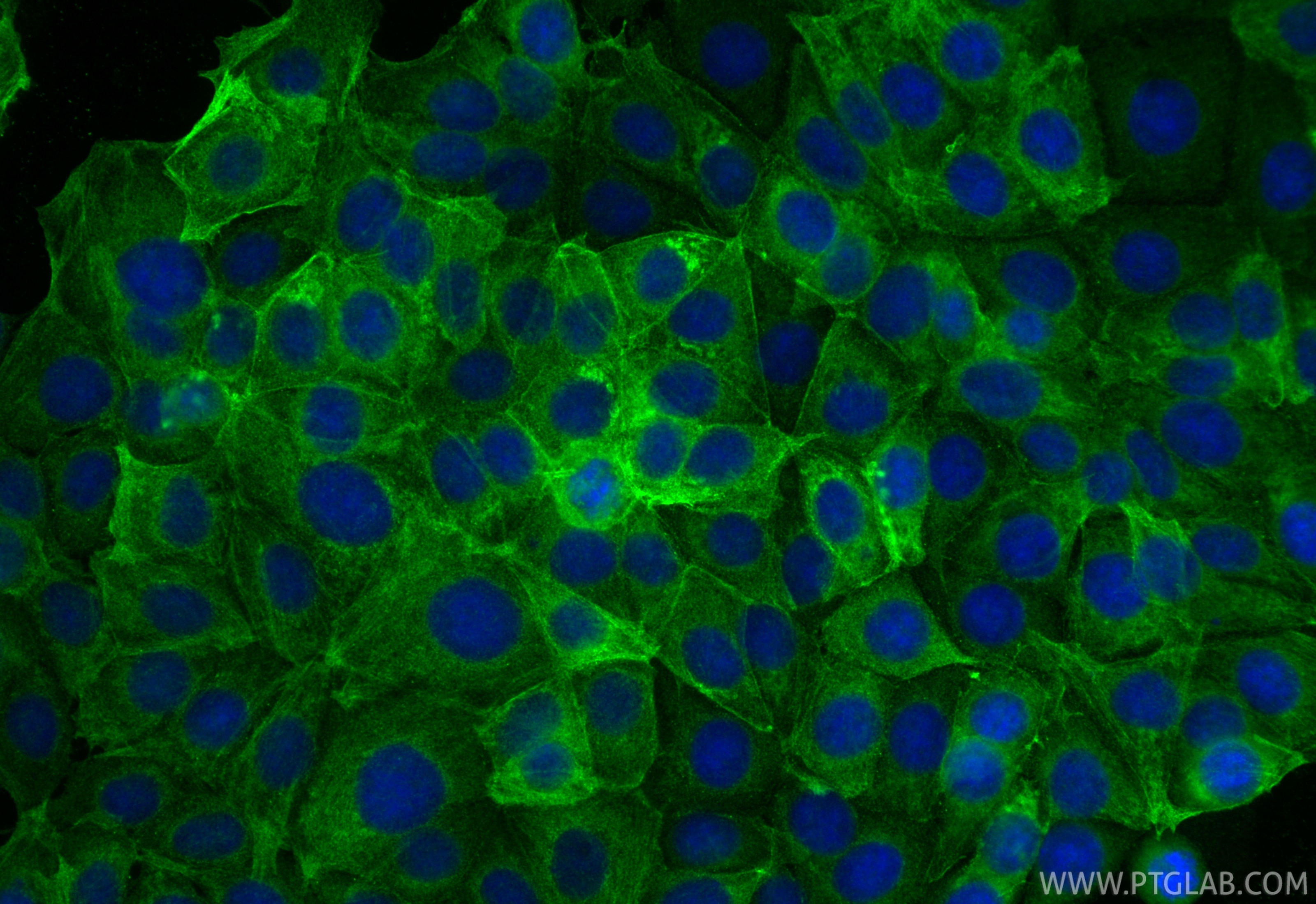 IF Staining of MCF-7 using 16417-1-AP Immunofluorescence (IF) / fluorescent staining of MCF-7 cells using BCAT2 Polyclonal antibody (16417-1-AP)
