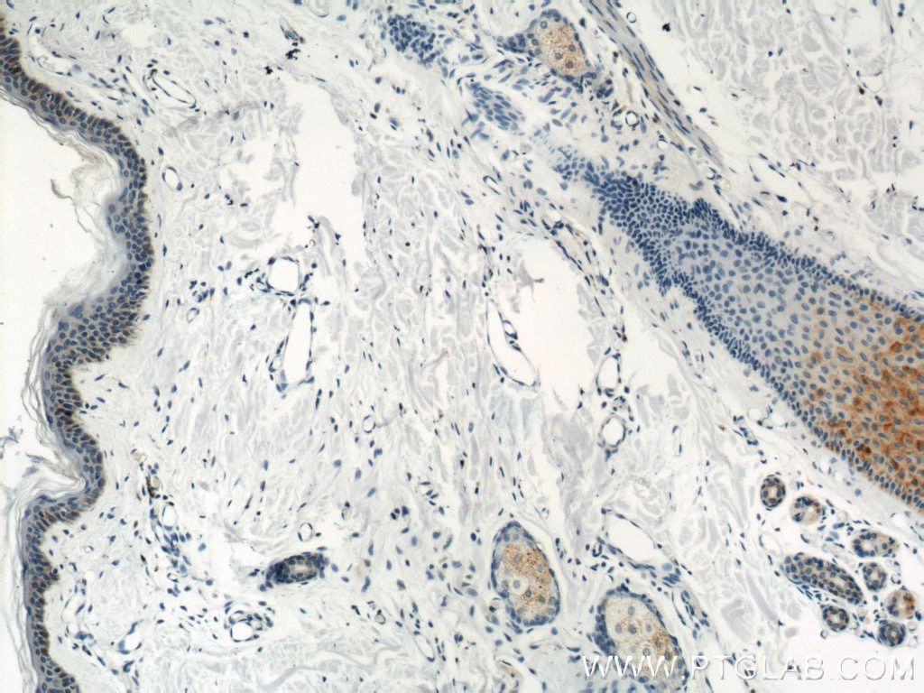 Immunohistochemistry (IHC) staining of human skin tissue using BCAT2 Polyclonal antibody (16417-1-AP)