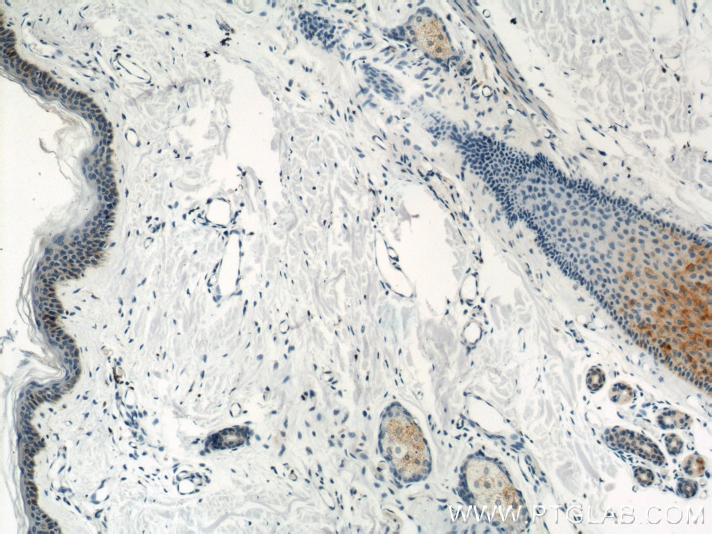 IHC staining of human skin using 16417-1-AP