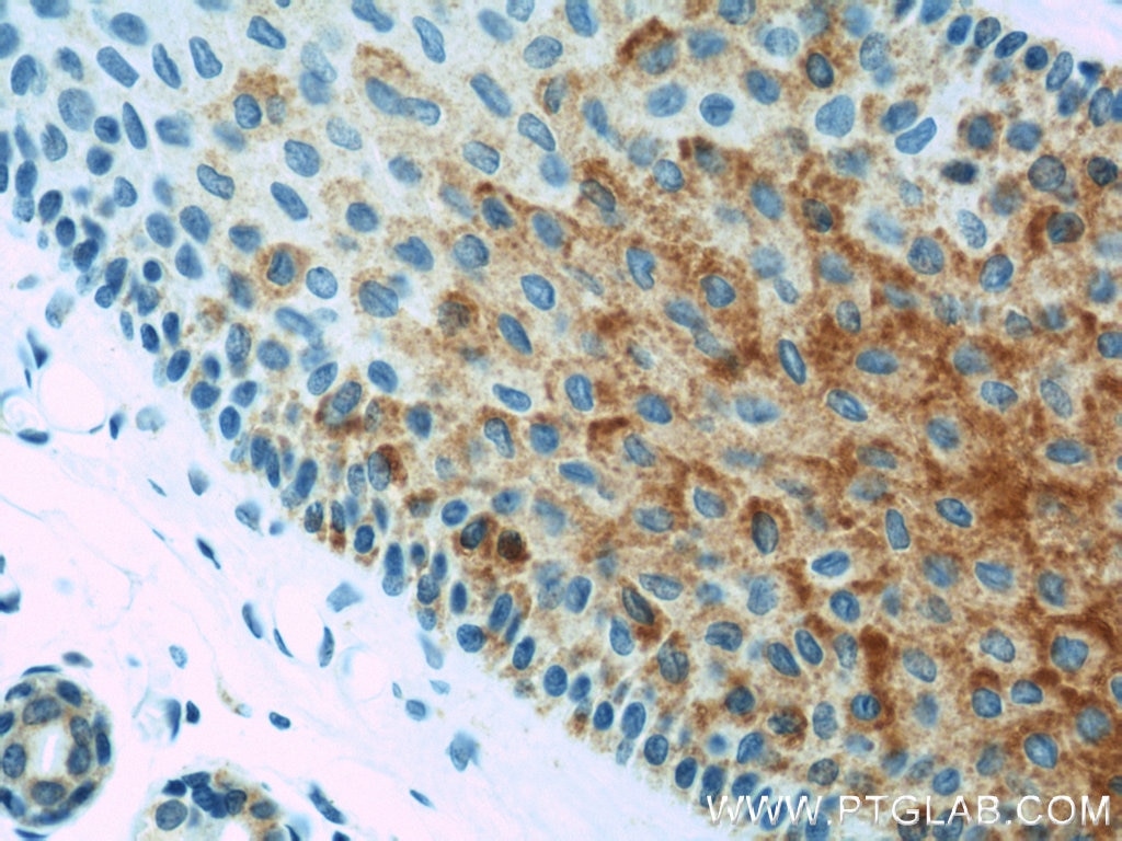 Immunohistochemistry (IHC) staining of human skin tissue using BCAT2 Polyclonal antibody (16417-1-AP)