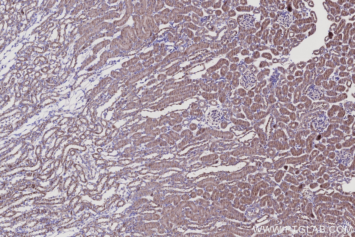 Immunohistochemistry (IHC) staining of mouse kidney tissue using BCAT2 Polyclonal antibody (16417-1-AP)