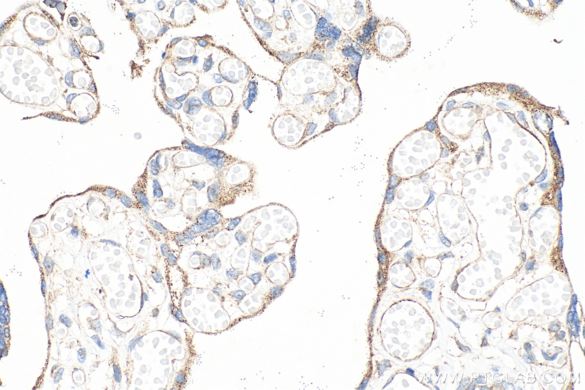Immunohistochemistry (IHC) staining of human placenta tissue using BCAT2 Polyclonal antibody (16417-1-AP)