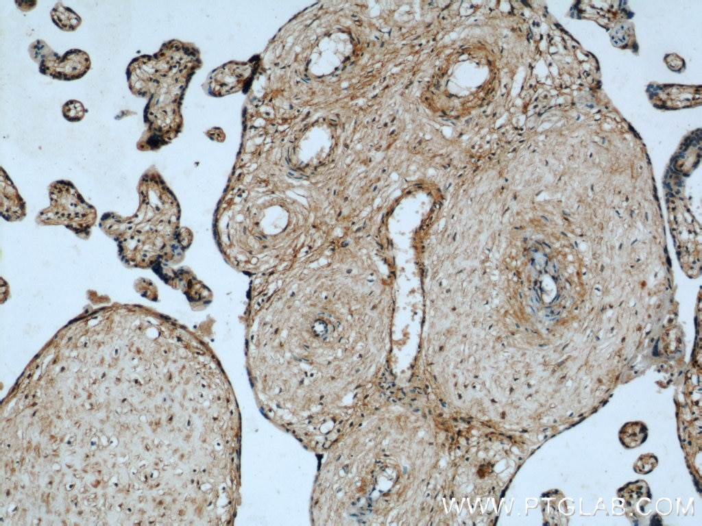 Immunohistochemistry (IHC) staining of human placenta tissue using BCAT2 Polyclonal antibody (16417-1-AP)