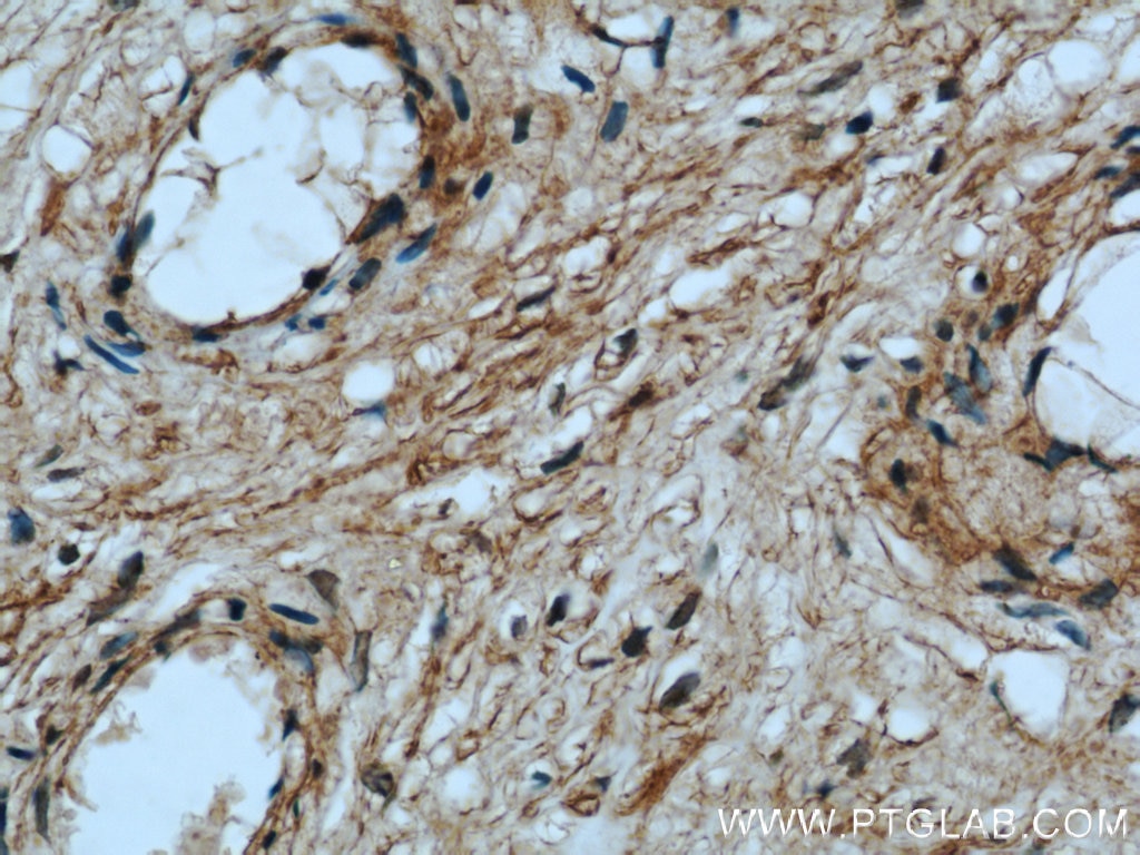 Immunohistochemistry (IHC) staining of human placenta tissue using BCAT2 Polyclonal antibody (16417-1-AP)