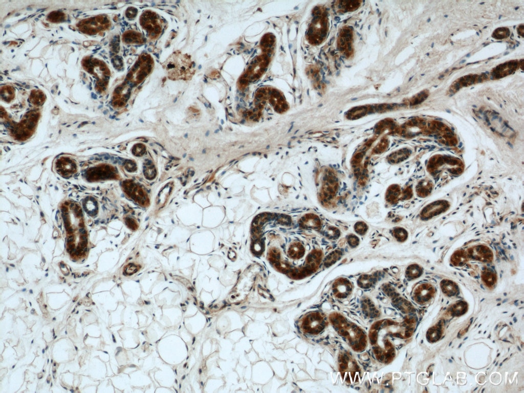 IHC staining of human skin using 16417-1-AP