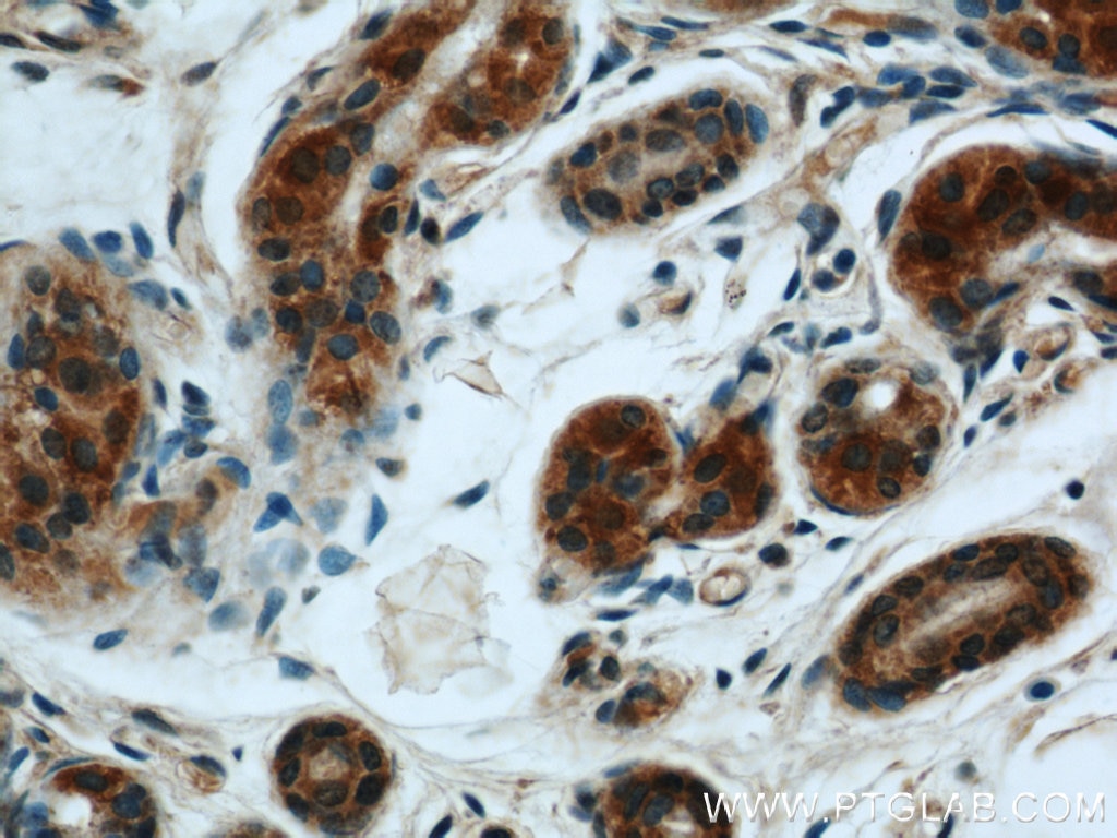 Immunohistochemistry (IHC) staining of human skin tissue using BCAT2 Polyclonal antibody (16417-1-AP)