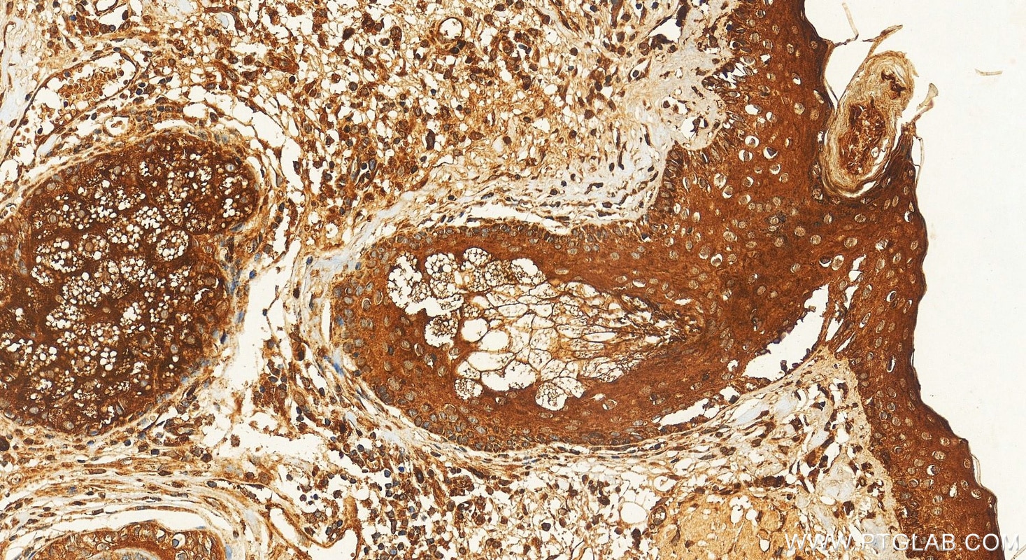 Immunohistochemistry (IHC) staining of human skin tissue using BCAT2 Polyclonal antibody (16417-1-AP)