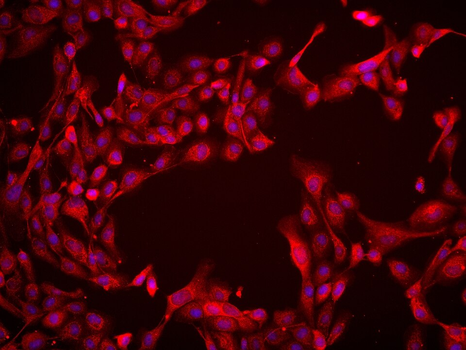 Immunofluorescence (IF) / fluorescent staining of A431 cells using BCAT2 Monoclonal antibody (68586-1-Ig)