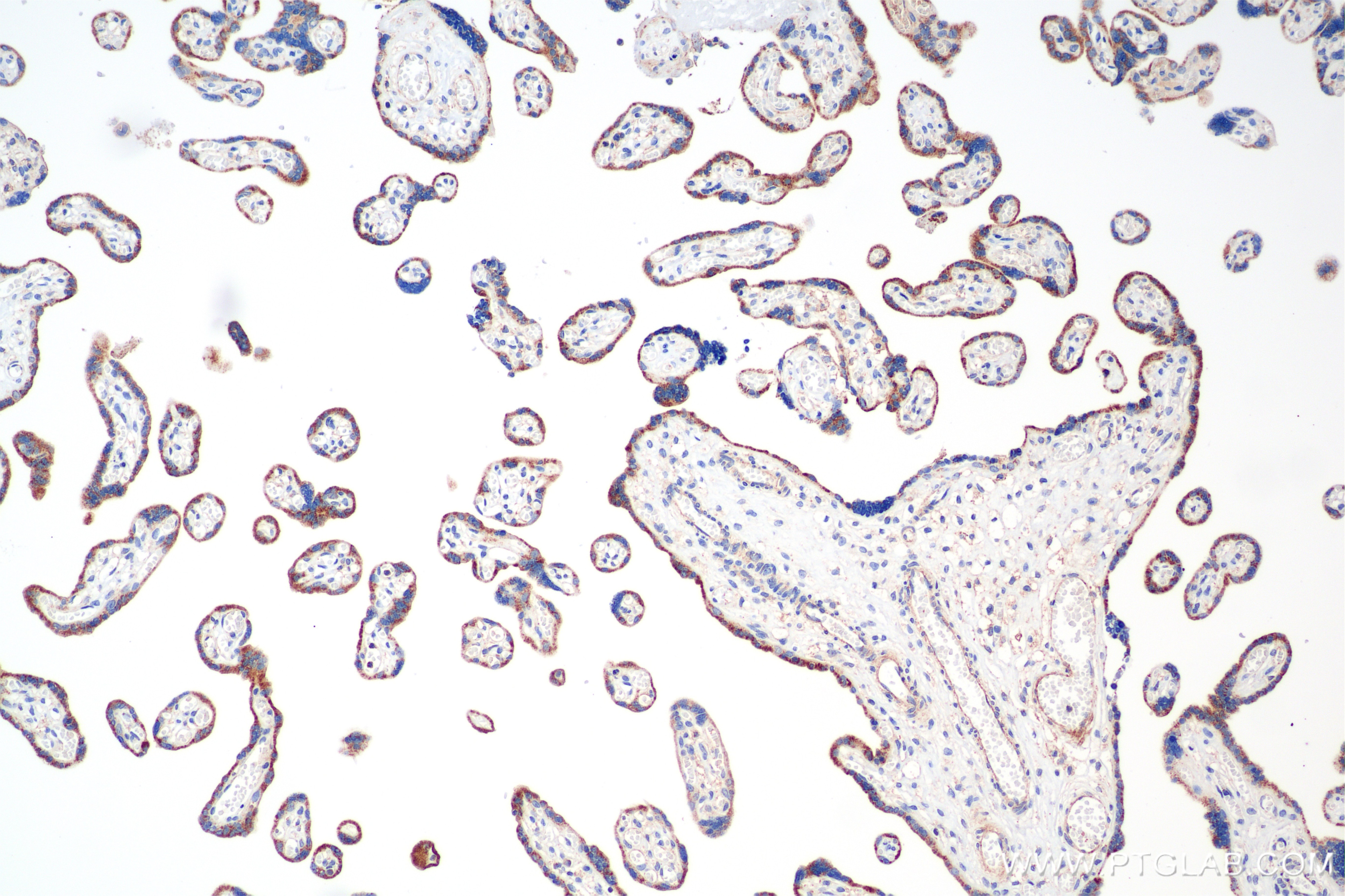 Immunohistochemistry (IHC) staining of human placenta tissue using BCAT2 Recombinant antibody (86367-1-RR)