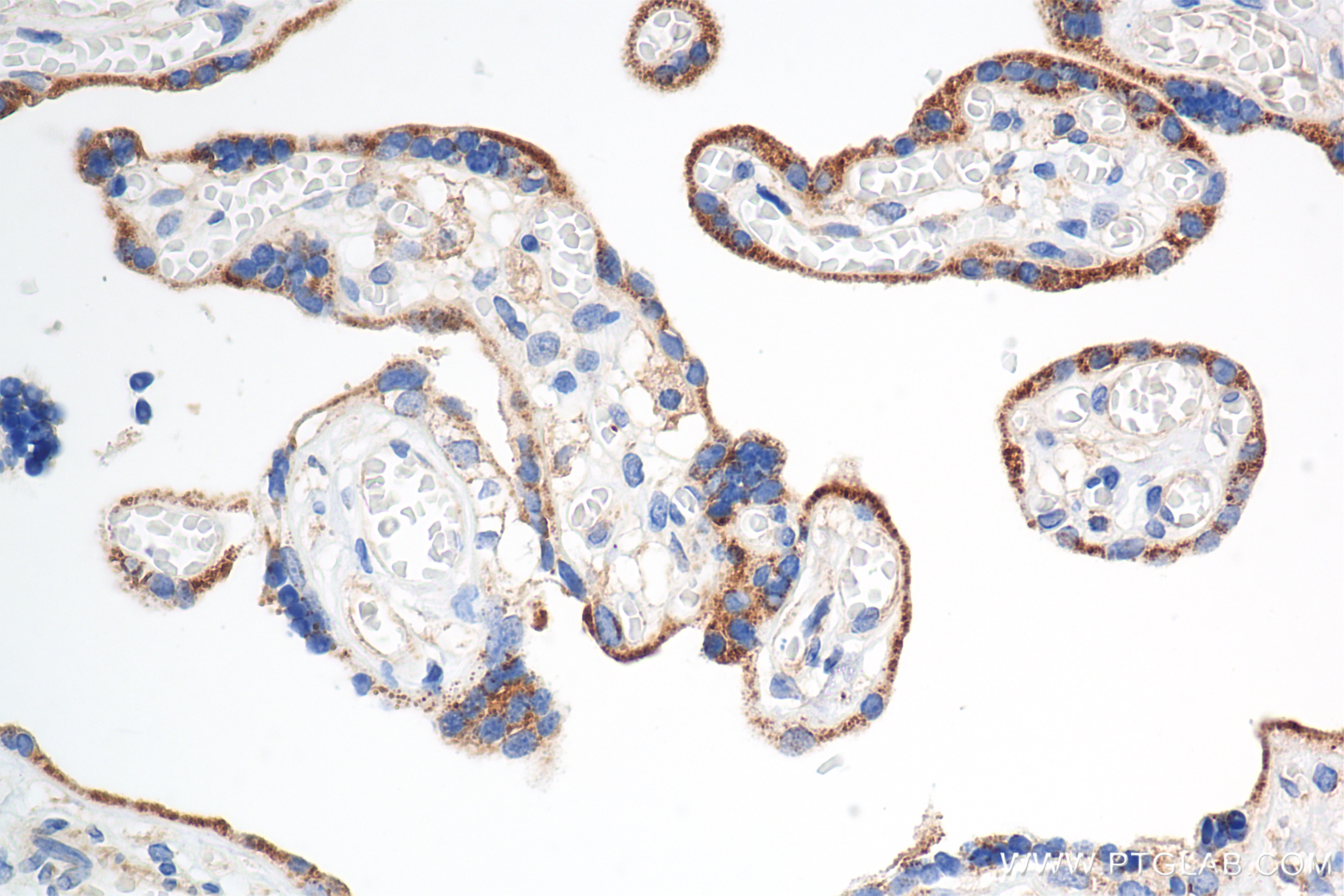 Immunohistochemistry (IHC) staining of human placenta tissue using BCAT2 Recombinant antibody (86367-1-RR)