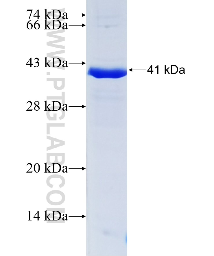 BCAT2 fusion protein Ag9595 SDS-PAGE