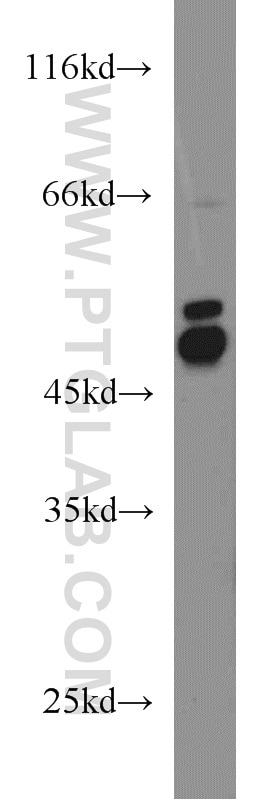 Western Blot (WB) analysis of A549 cells using BCCIP Polyclonal antibody (16043-1-AP)