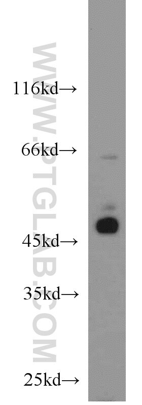 Western Blot (WB) analysis of HeLa cells using BCCIP Polyclonal antibody (16043-1-AP)
