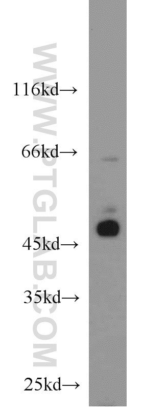 Western Blot (WB) analysis of HeLa cells using BCCIP Polyclonal antibody (16043-1-AP)