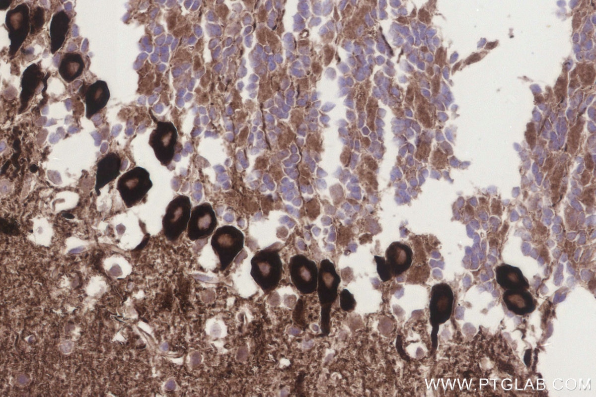 Immunohistochemistry (IHC) staining of mouse cerebellum tissue using BCDIN3D Recombinant monoclonal antibody (83309-1-RR)
