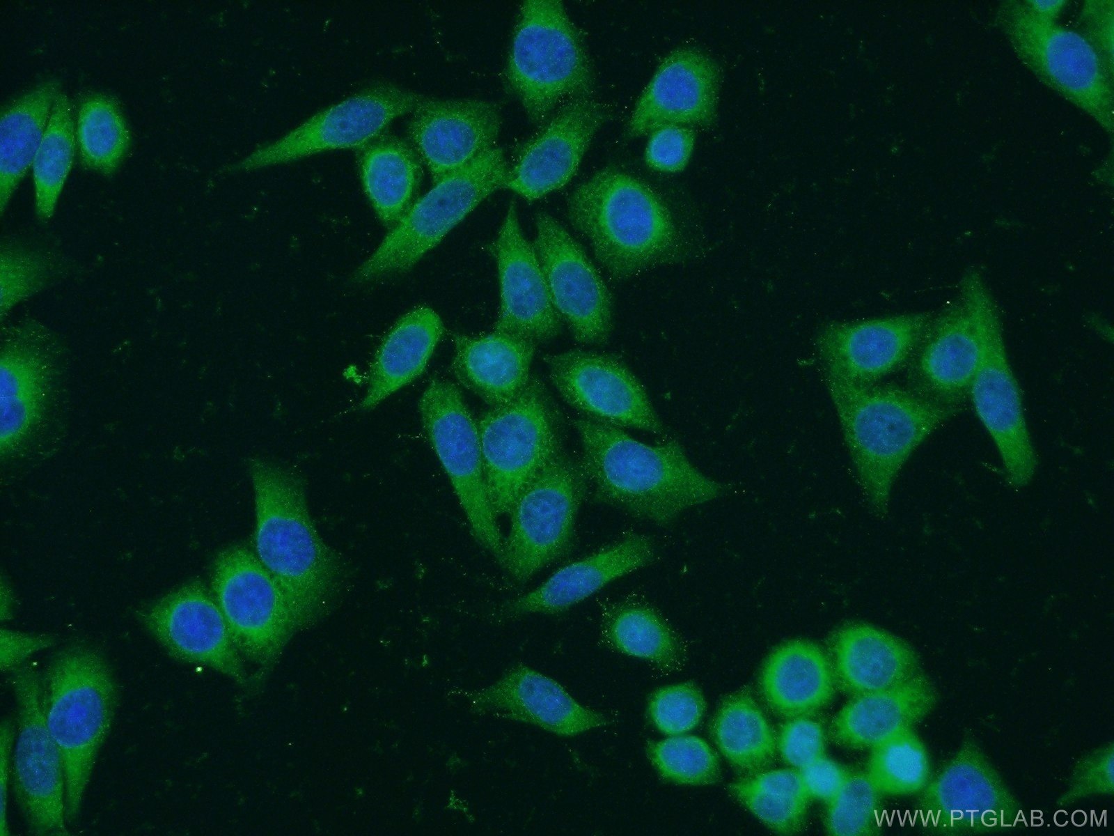 Immunofluorescence (IF) / fluorescent staining of HeLa cells using BCHE Polyclonal antibody (23854-1-AP)