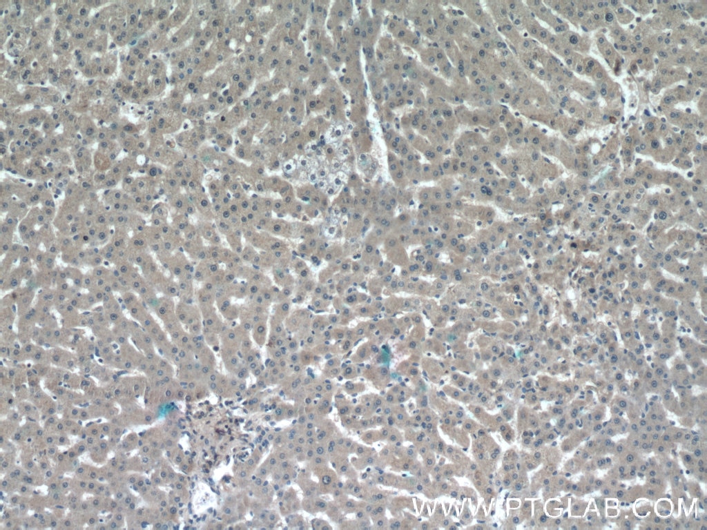 Immunohistochemistry (IHC) staining of human liver tissue using BCHE Polyclonal antibody (23854-1-AP)