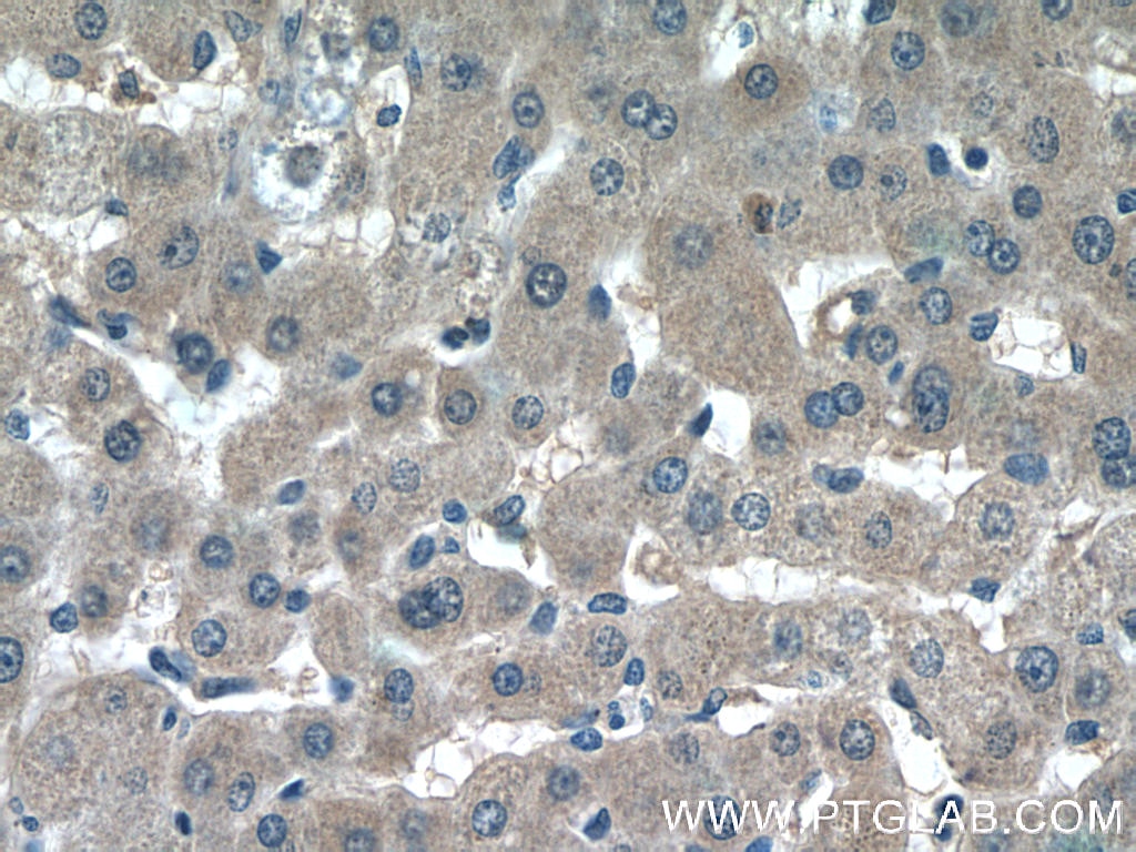 Immunohistochemistry (IHC) staining of human liver tissue using BCHE Polyclonal antibody (23854-1-AP)