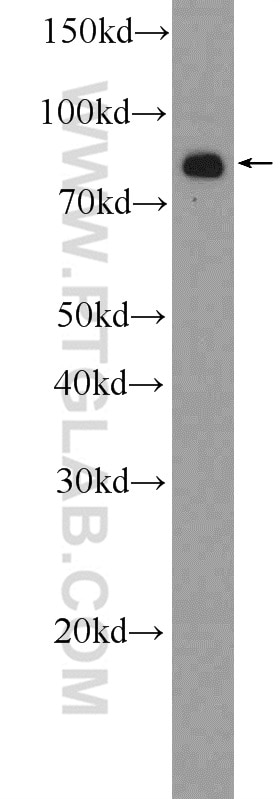 Western Blot (WB) analysis of HeLa cells using BCHE Polyclonal antibody (23854-1-AP)