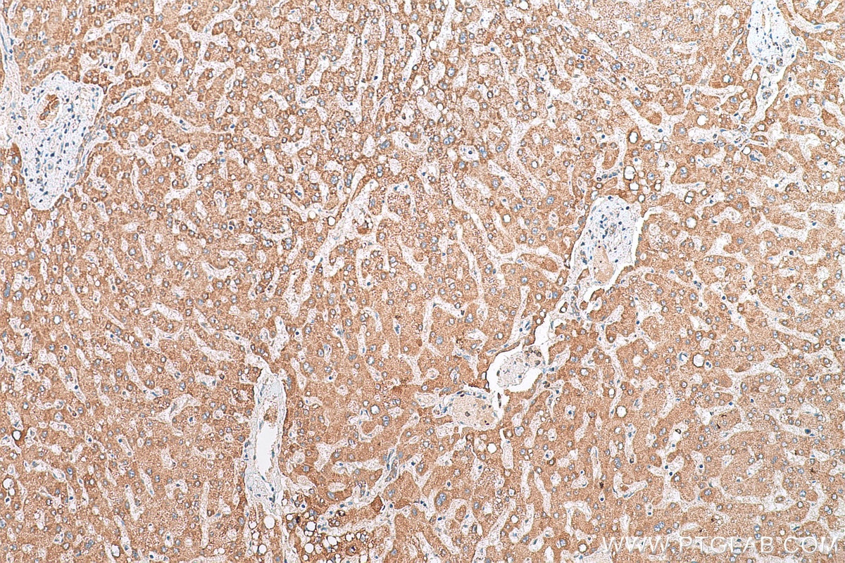 Immunohistochemistry (IHC) staining of human liver tissue using BCKDHA Polyclonal antibody (30028-1-AP)