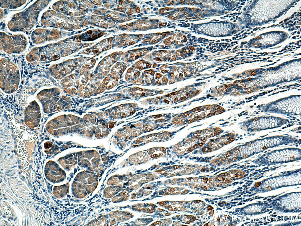 IHC staining of human stomach using 13685-1-AP