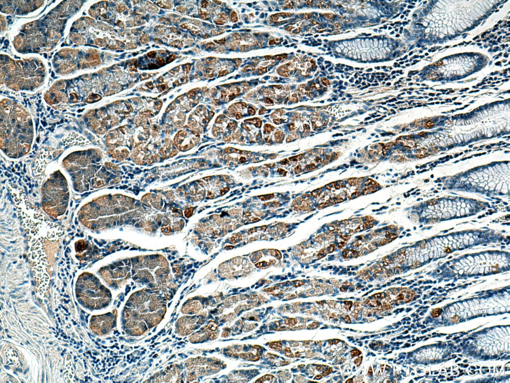 Immunohistochemistry (IHC) staining of human stomach tissue using BCKDHB Polyclonal antibody (13685-1-AP)