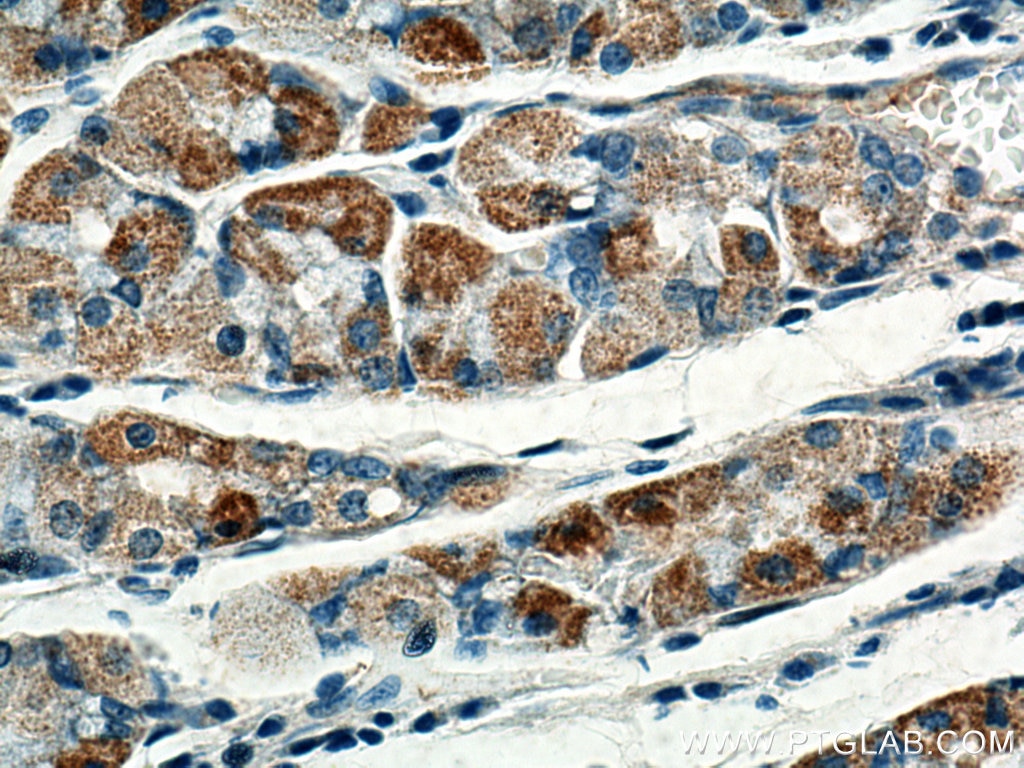 Immunohistochemistry (IHC) staining of human stomach tissue using BCKDHB Polyclonal antibody (13685-1-AP)