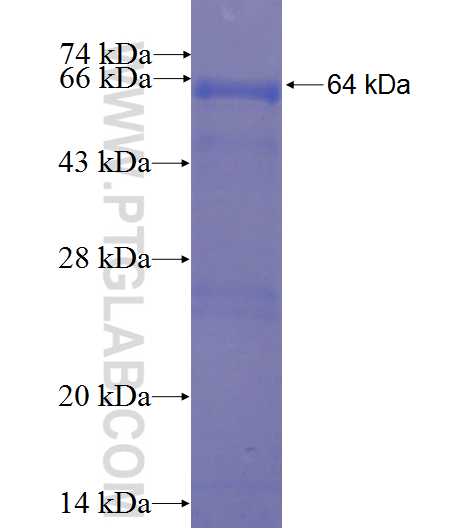 BCKDHB fusion protein Ag4552 SDS-PAGE