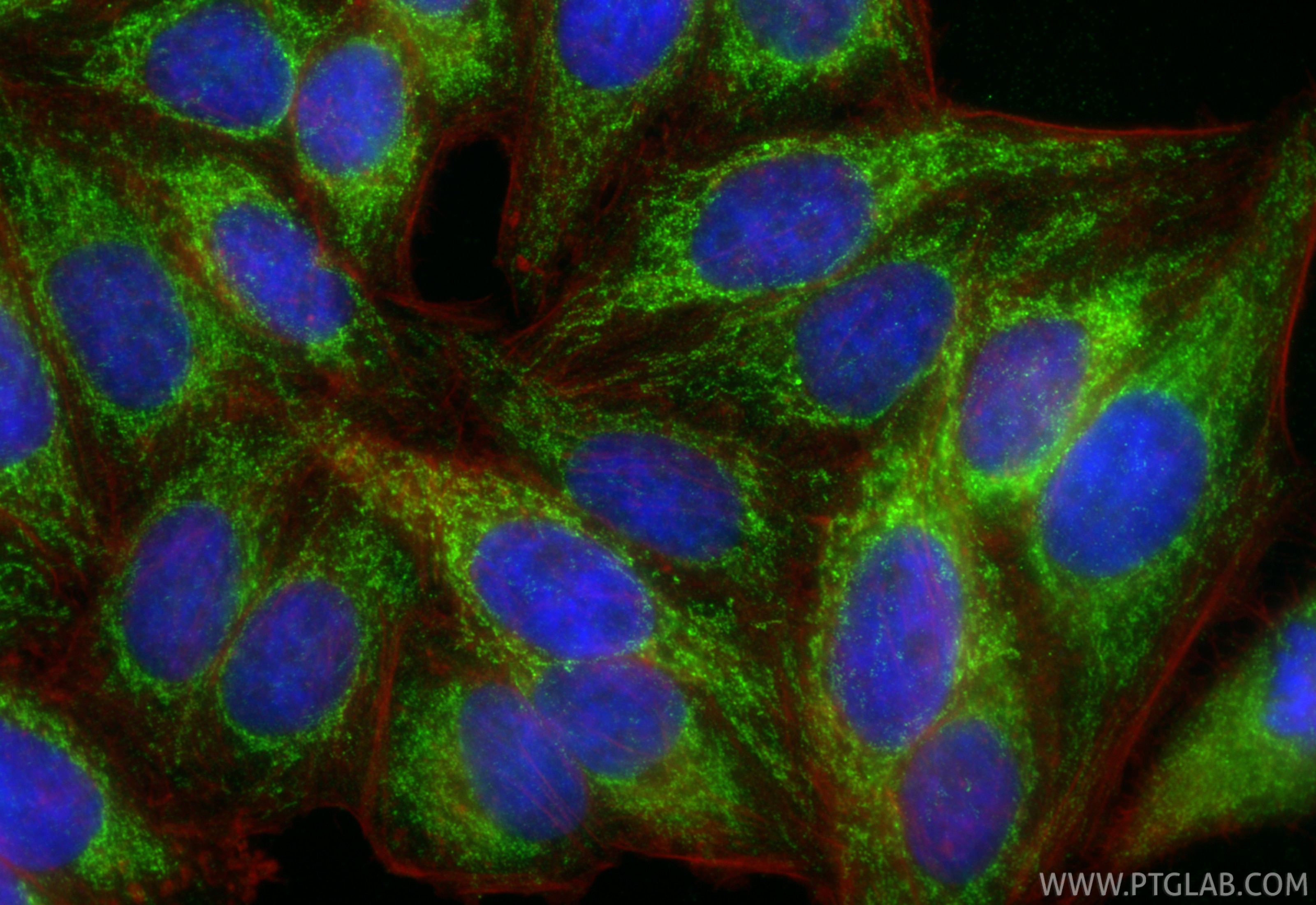 IF Staining of HepG2 using 15718-1-AP Immunofluorescence (IF) / fluorescent staining of HepG2 cells using BCKDK Polyclonal antibody (15718-1-AP)