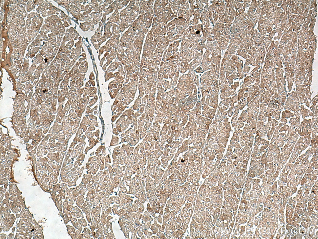 IHC staining of human heart using 15718-1-AP