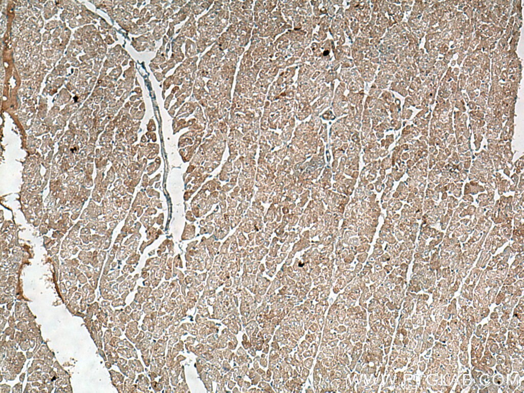 Immunohistochemistry (IHC) staining of human heart tissue using BCKDK Polyclonal antibody (15718-1-AP)