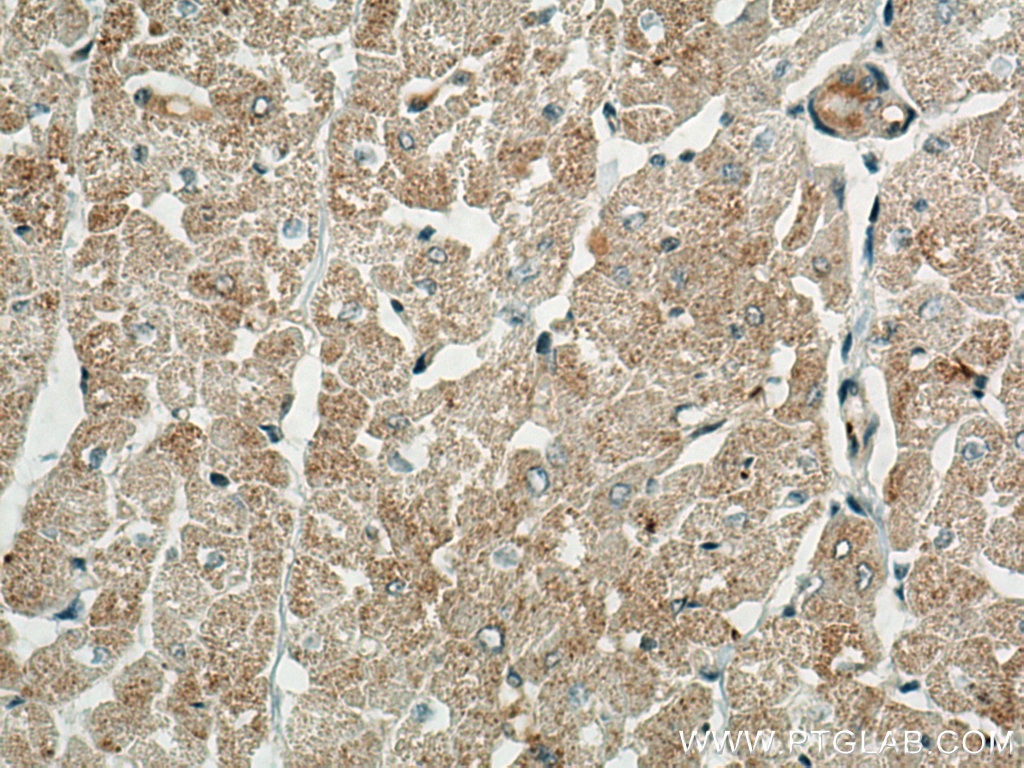 Immunohistochemistry (IHC) staining of human heart tissue using BCKDK Polyclonal antibody (15718-1-AP)