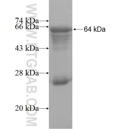 BCKDK fusion protein Ag8395 SDS-PAGE
