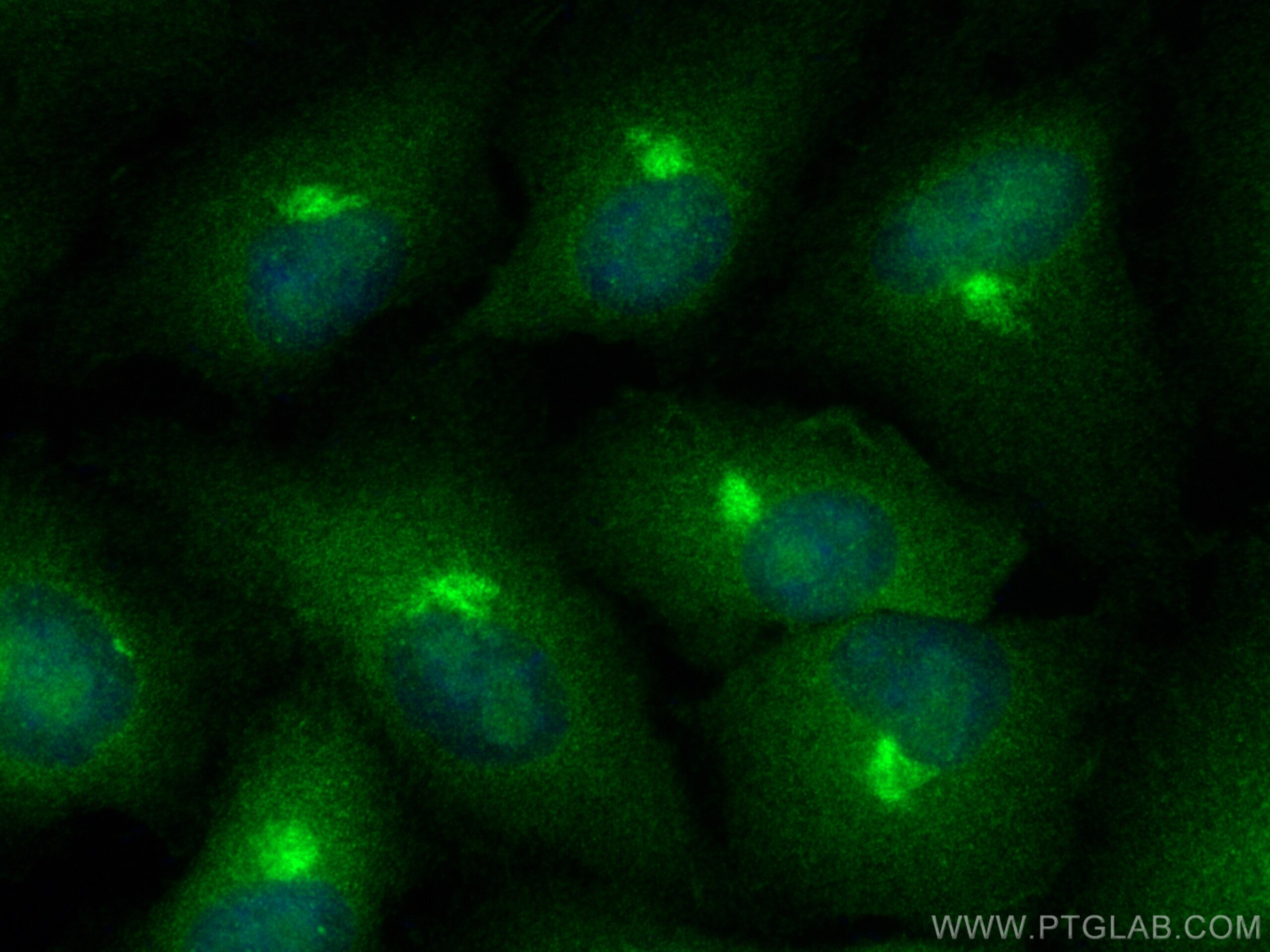 Immunofluorescence (IF) / fluorescent staining of A549 cells using BCL10 Polyclonal antibody (50180-1-AP)