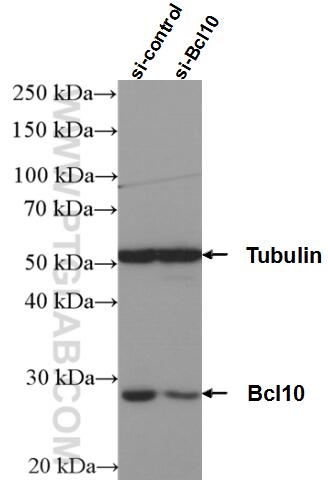 WB analysis of K-562 using 50180-1-AP