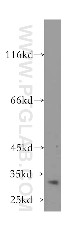 BCL10 Polyclonal antibody