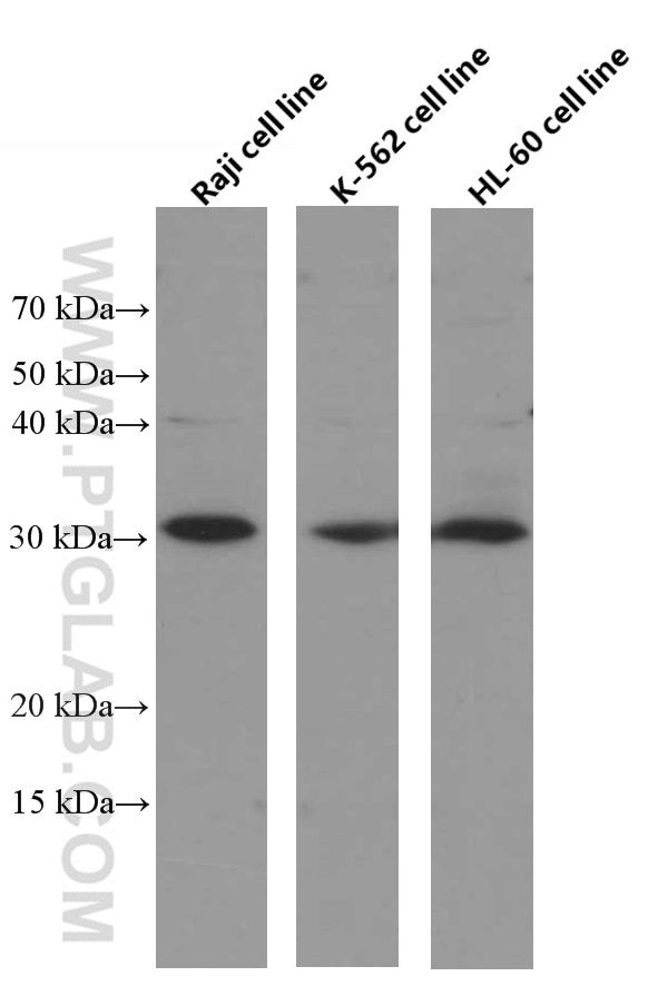 Western Blot (WB) analysis of Raji cells using BCL10 Monoclonal antibody (66556-1-Ig)