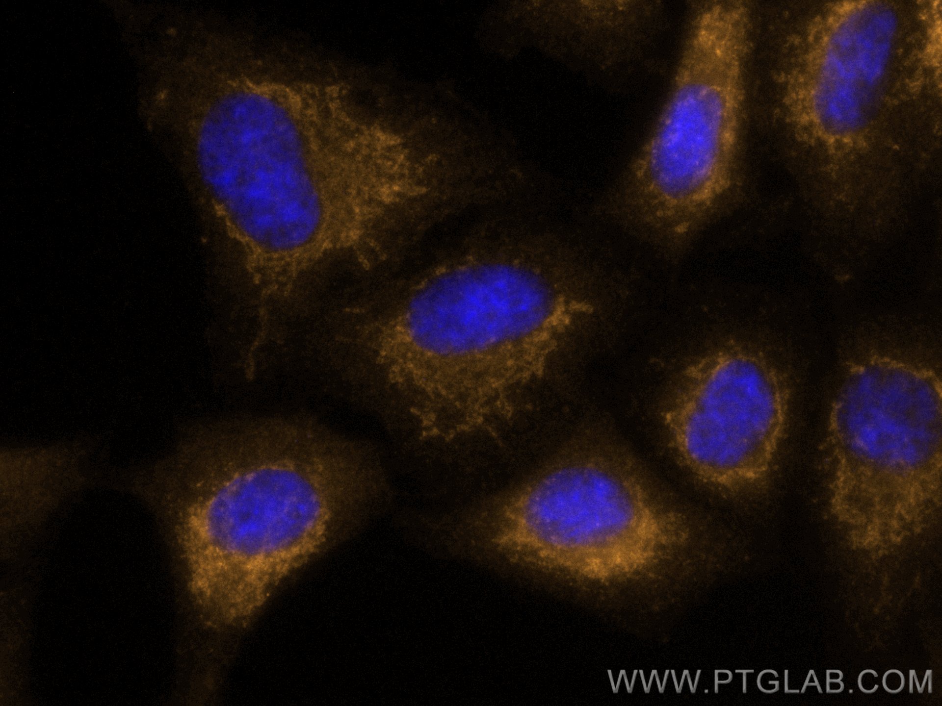 Immunofluorescence (IF) / fluorescent staining of A549 cells using CoraLite®555-conjugated BCL10 Polyclonal antibody (CL555-17732)