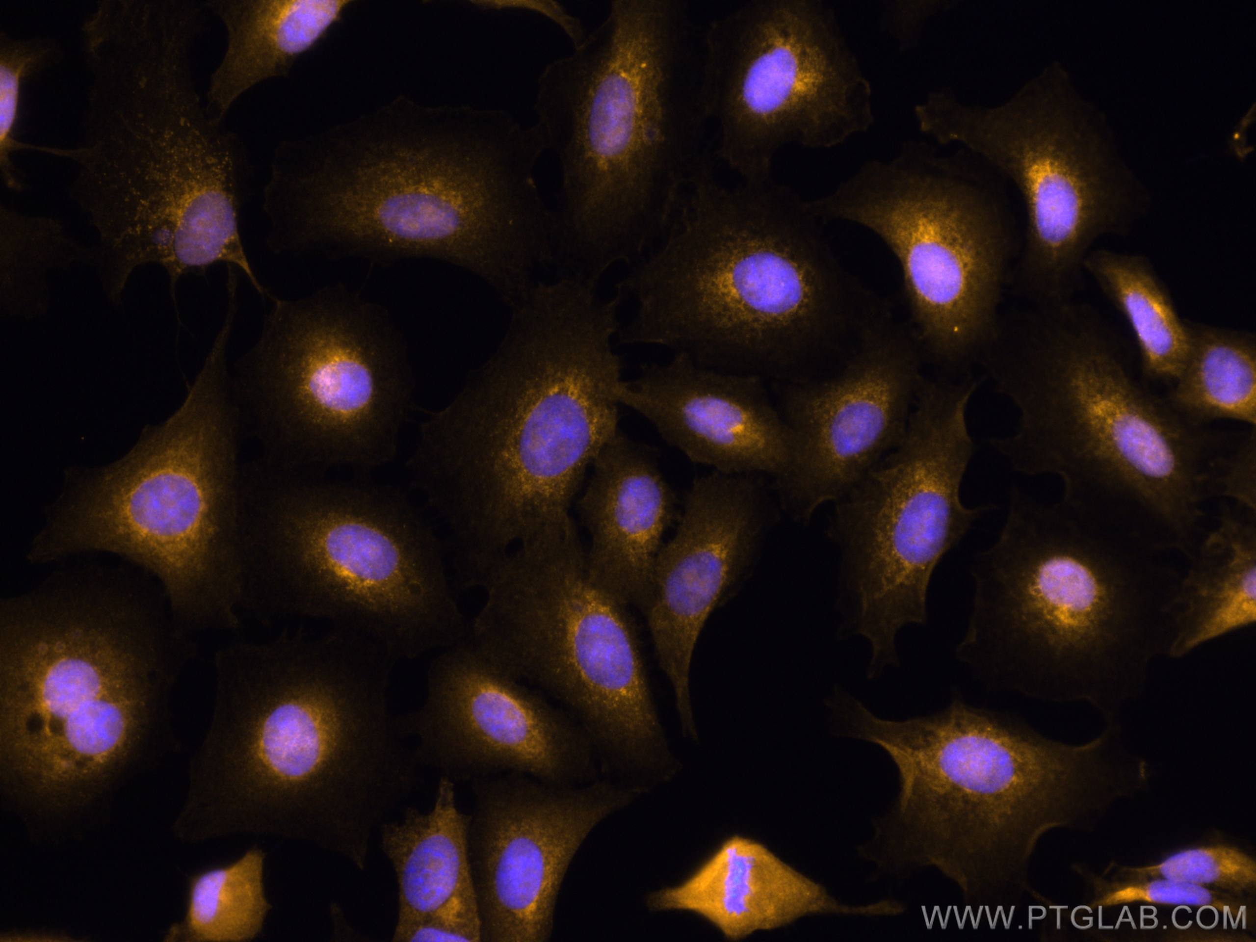 Immunofluorescence (IF) / fluorescent staining of A549 cells using CoraLite®555-conjugated BCL10 Polyclonal antibody (CL555-50180)