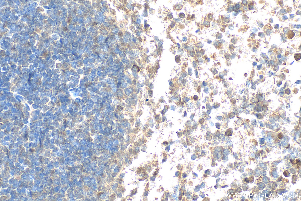 Immunohistochemistry (IHC) staining of mouse spleen tissue using BCL11A Polyclonal antibody (11613-1-AP)