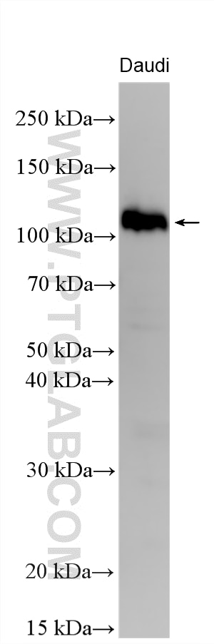 Western Blot (WB) analysis of various lysates using BCL11A Polyclonal antibody (11613-1-AP)