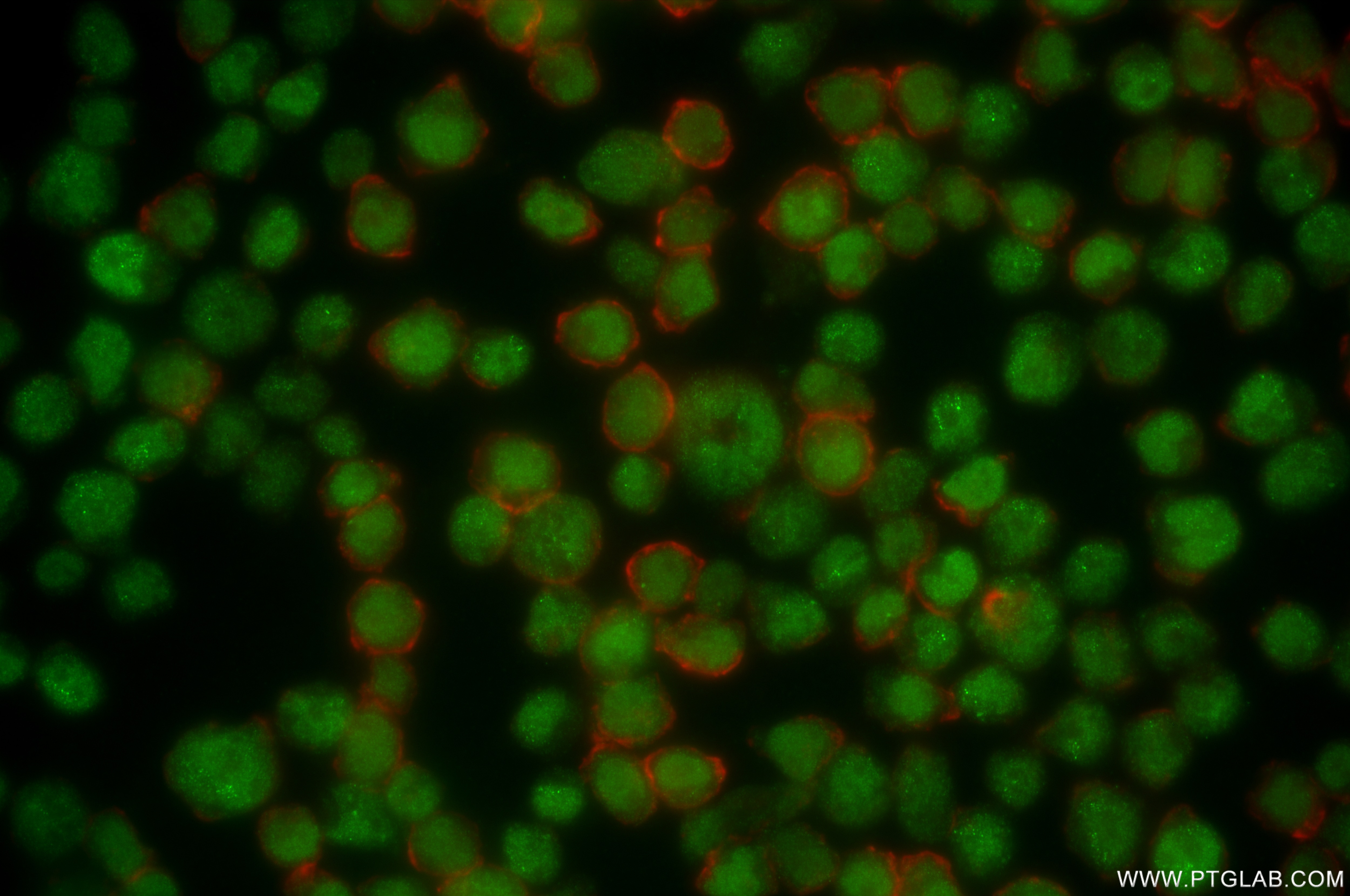 Immunofluorescence (IF) / fluorescent staining of Jurkat cells using BCL11A Recombinant antibody (84930-3-RR)