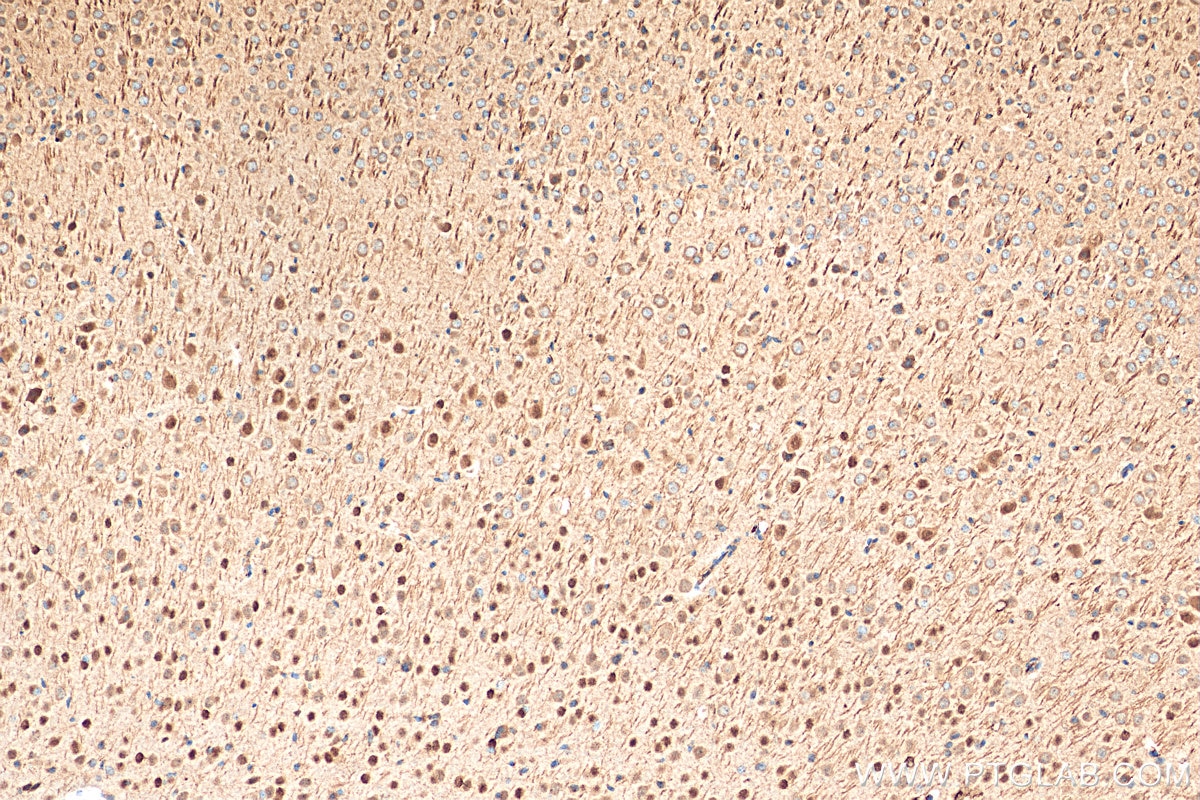 Immunohistochemistry (IHC) staining of mouse brain tissue using BCL11B Polyclonal antibody (55414-1-AP)