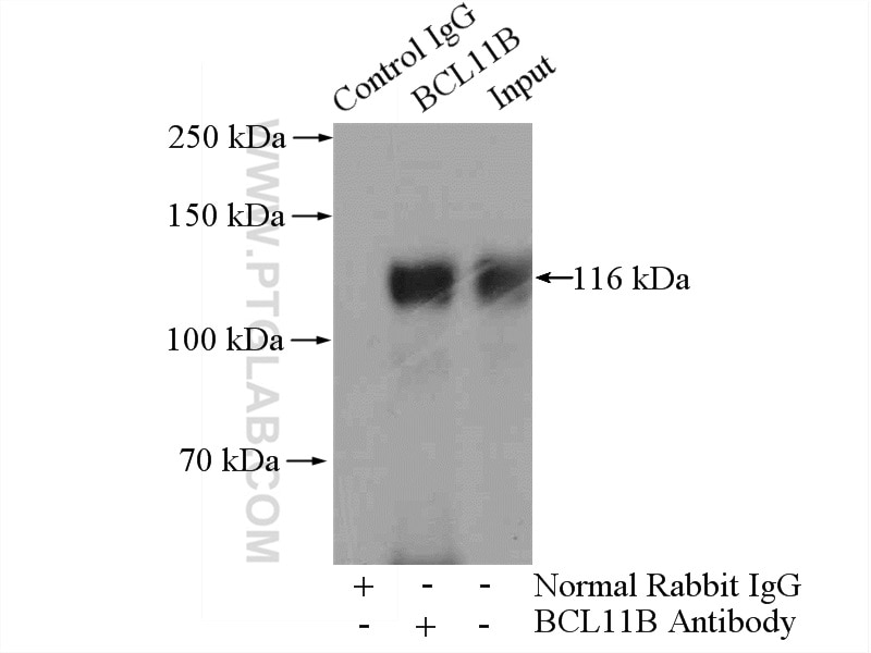 Immunoprecipitation (IP) experiment of Jurkat cells using BCL11B Polyclonal antibody (55414-1-AP)