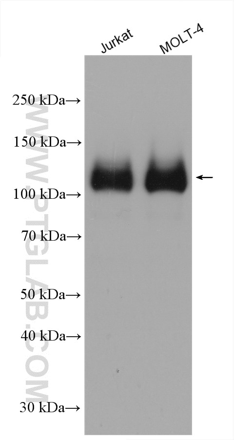 Western Blot (WB) analysis of various lysates using BCL11B Polyclonal antibody (55414-1-AP)