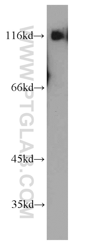 Western Blot (WB) analysis of mouse thymus tissue using BCL11B Polyclonal antibody (55414-1-AP)