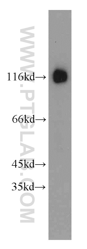 Western Blot (WB) analysis of Jurkat cells using BCL11B Polyclonal antibody (55414-1-AP)